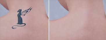 Dovme Sildirmek Istiyorum Ama Bu Islem Nasil Oluyor Fiyati Nedir Gibi Aklinizda Sorular Var Ise Bu Yazimizda Sorularinizin Cevabini B Dovme Tattoo Beautiful