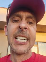 Experiences with Bionic Smile Surgery