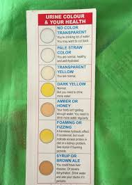 Urine Colour And Your Health Urinal Color Of Urine Health