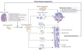 Image result for Platelet Dysfunction