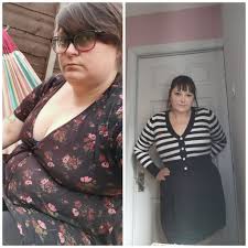 Hi, hope everyone is well ❤️ Am 8 months out from sleeve and all has been  fine but the last few months I've had awful pain in my chest and upper  stomach.