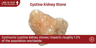 Pin On Cystine Kidney Stones Cystinuria