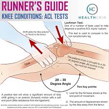 Image result for Lachman Test