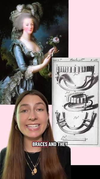 Marie Antoinette had braces and they were absolutely terrifying! Before she  could marry Louis, the Dauphin of France she had to undergo a  transformation fit for Versailles. The result? Straighter ...