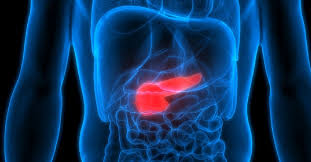 Both acute and chronic pancreatitis treatment may require hospitalization. Pancreatite Acuta E Cronica Dott Gianfranco Cavaliere