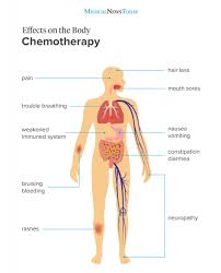 the 10 most common chemotherapy side effects