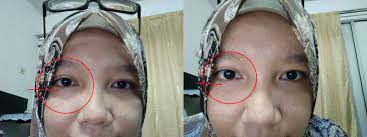 Lingkaran hitam di bawah mata cenderung lebih mempengaruhi penampilan anda daripada sekedar kerutan atau uban. Cara Hilangkan Lingkaran Gelap Dan Kedutan Bawah Mata Lovely Bee
