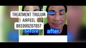 Browse real photos from our stay. Detox Trulum Synergy Home Facebook