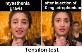 Image result for Tensilon Test