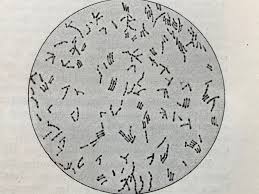 Diphtherie ist eine infektionskrankheit, die durch das bakterium corynebacterium diphtheriae ausgelöst wird. Histologie Die Diphtherie Der Gaumenmandel Teil 1