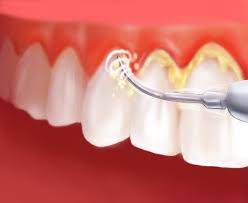Maybe you would like to learn more about one of these? Poli Dokter Gigi Sinar Medik