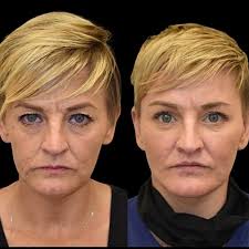 TOP 10 BEST Cosmetic Surgeons near Worthington, OH