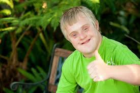 Hasil gambar untuk anak down syndrome nasib pernikahan