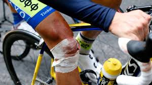 O contador de dias online é a melhor ferramenta para calcular quanto tempo existe entre duas datas. Contador Muss Nach Einem Schienbeinbruch Nicht Operiert Werden Mehr Sport