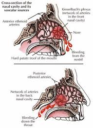 Image result for Epistaxis