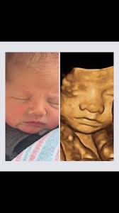 Keep guessing! Anyone can win. If you are not pregnant now you can always  gift it to someone and make a great baby shower gift.