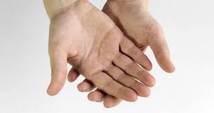 avuc ici yanmasi terlemesi ve kasinmasi neden olur evde nasil gecer avuc ici yanmasi terlemesi ve kasinmasina ne iyi gelir saglik haberleri