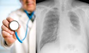 The two sorts of mesothelioma claims are … Mesothelioma Lawyers Asbestos Attorneys Rockford Il