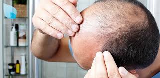 A cosa è dovuto questo fenomeno e quali sono i rischi quando si esce dall'europa? Trapianto Capelli In Turchia Esperienze Risultati O Illusione Hairclinic