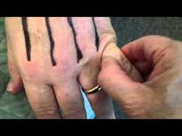 Sinus And Post Nasal Drip Relief Hand Reflexology Tip Youtube Hand Reflexology Post Nasal Drip Remedy Sinusitis