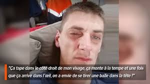 ᐈ azul rey fondo de stock, imágenes fondos azul rey | descargar en depositphotos®. Touche Par Une Maladie Tres Rare Laurent A Des Maux De Tete Si Forts Qu Il A Parfois Envie De Se Taper La Tete Contre Les Murs Rtl Info