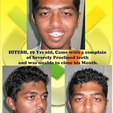 Dr. Priti Bhatt (Synergy Dental Clinics) in Borivali West,Mumbai