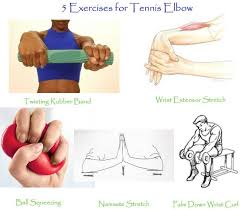 The tyler twist rehab protocol is pretty straightforward, but best understood when viewed via video. Tennis Elbow Treatment I Home Care Physiotherapy Reliva Physiotherapy Rehab