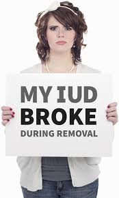 Mild side effects mild side effects* of paragard can include: Paragard Iud Removal Complication Lawsuits 2021 Updates Info