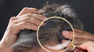 Auslöser ist wahrscheinlich eine störung des immunsystems. Haarausfall Das Sollten Manner Nicht Tun