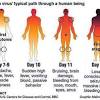 Ebola virus disease (evd) is a serious, often fatal disease in humans. 1