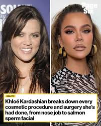 Khloé Kardashian is the latest to get candid about her glow up.