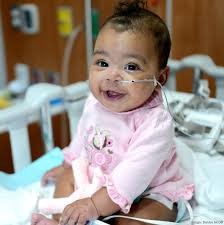 Littlest patients benefit from Children's of Alabama cardiology care  technology