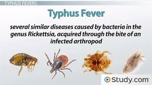 Image result for Typhus