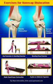 Recovery Exercises Prevention Of Kneecap Dislocation Or Patellar Dislocation Knee Exercises Knee Injury Recovery Exercise
