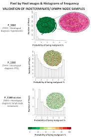 The rom is also compatible with the realme 6s and the indian edition of the realme 6i. Cancers Free Full Text Maldi Msi As A Complementary Diagnostic Tool In Cytopathology A Pilot Study For The Characterization Of Thyroid Nodules Html