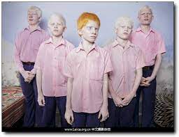 荷赛 world press photo 2014 获奖作品 jongen poses familieportret fotografie