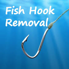 Image result for Fishhook Removal