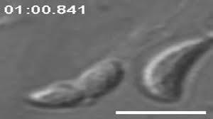 Info gaji karyawan pt asabri di situs jobplanet terbaru tahun 2017 yang bersumber dari karyawan/mantan karyawannya. Genetic Impairment Of Parasite Myosin Motors Uncovers The Contribution Of Host Cell Membrane Dynamics To Toxoplasma Invasion Forces Bmc Biology Full Text