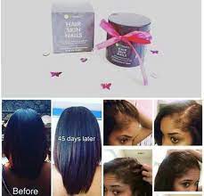 Edges Been Breaking Off Get Them Back Fast Healthy Hair Natural Hair Styles Hair Care