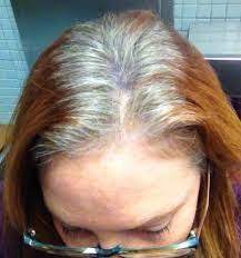 Image Result For How To Grow Out Dyed Hair To Gray Transition To Gray Hair Gray Hair Growing Out Gray Hair Highlights