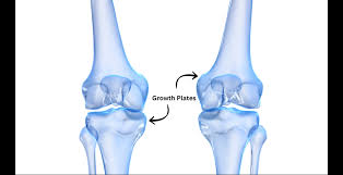 Image result for Growth Plate