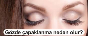 Gozde Capaklanma Neden Olur Nasil Gecer Saglikdio Com Gozler Erkek Sagligi Estetik