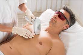 Leesburg laser center 116 edwards ferry rd ne leesburg, va. The Hairy Truth About Laser Hair Removal Leesburg Va Avie Medspa Leesburg Va