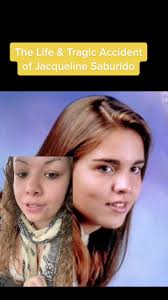 Miss Jacqueline Accident