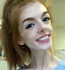 This young woman only ate one piece of bread a day for 5 years. Now grab a  tissue before you see her today