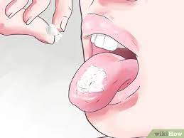 3 Formas De Aliviar La Lengua Quemada Wikihow