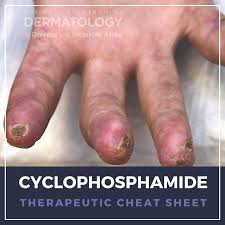 Image result for Cyclophosphamide