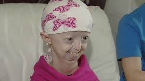 Progeria campaigner Hayley Okines dies aged 17