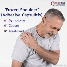 Image result for Frozen Shoulder