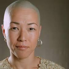 Not all chemotherapy drugs cause hair loss. 4 Things To Ask About Cancer And Hair Loss Cancer Net